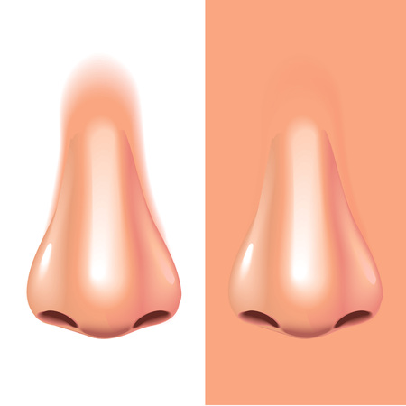 Choosing the Right Filler for Your Face Structure
