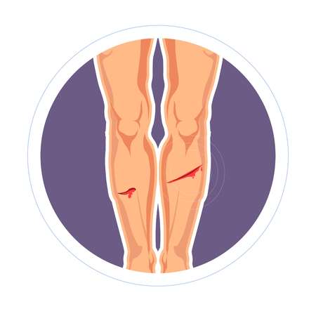 Proper Injection Techniques for Stability