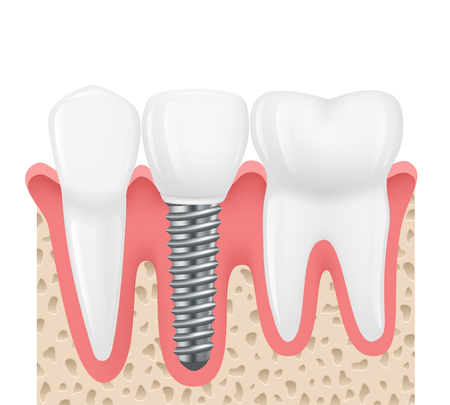 Effectiveness and Treatment Outcomes