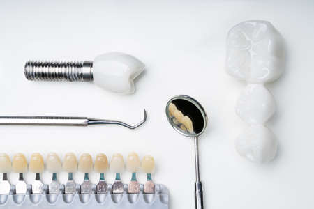 How to Save Money on Veneers: Best Strategies for Cutting Costs