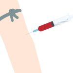 What to Expect During and After a Non-Surgical Butt Lift Session