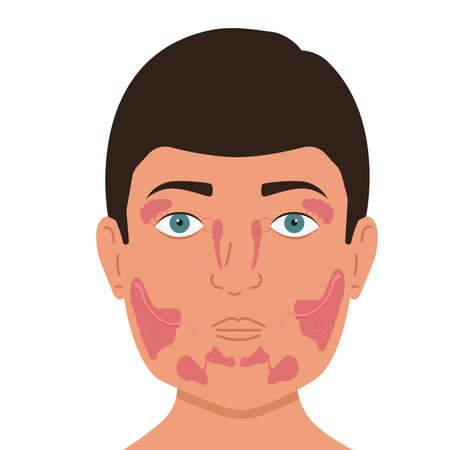 Popular Injectable Options for Facial Contouring