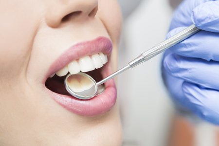 Teeth Whitening for Sensitive Teeth: Affordable Solutions That Work