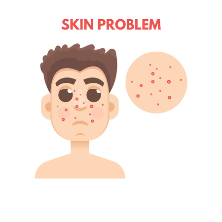 Be Gentle with Your Skin