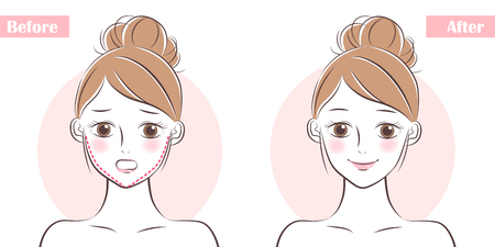 How to Choose the Right Cleanser for Acne-Prone Skin