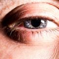 The Science Behind Eyelid Tightening: How These Treatments Work