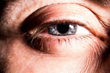 The Science Behind Eyelid Tightening: How These Treatments Work