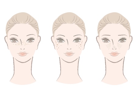 Best Laser Options for Various Skin Tones