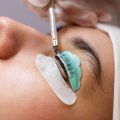 Electrolysis vs. Other Hair Removal Methods: Which is the Most Effective?