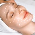 How to Prepare Your Skin for a Chemical Peel