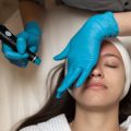 How Many Laser Hair Removal Sessions Do You Really Need?
