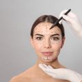 Cheek Fillers for Different Face Shapes: A Personalized Approach