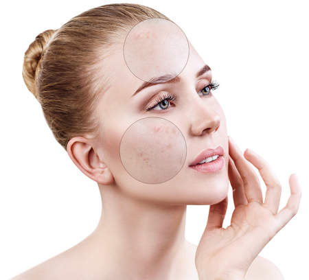 The Role of Chemical Peels in Anti-Aging Skincare