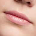 How to Prepare for Lip Fillers on a Budget