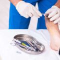 Ultrasound and Radiofrequency Treatments for Non-Surgical Eyelifts
