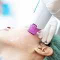 How Often Should You Get Laser Skin Resurfacing for Optimal Results?