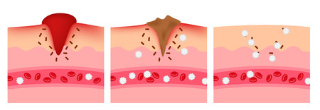 Top Moisturizers for Post-Laser Recovery