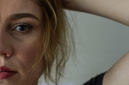 PRP Therapy for Male vs. Female Hair Loss: Does It Work Differently for Men and Women?