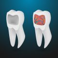 How to Strengthen Your Teeth Naturally and Reduce Dental Costs