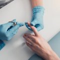Does Jawline Sculpting Hurt? A Detailed Look at Pain, Numbing, and Recovery