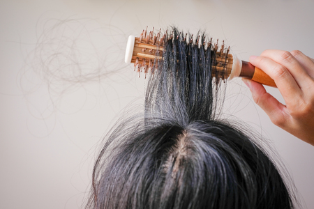 DIY PRP Therapy for Hair Loss: Why You Should Leave It to the Professionals