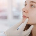 What to Expect After Getting Dermal Fillers: Recovery and Aftercare Tips
